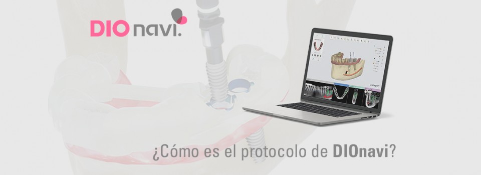 ¿Cómo es el protocolo DIOnavi?